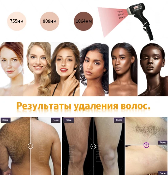 product-545-570 product-545-570